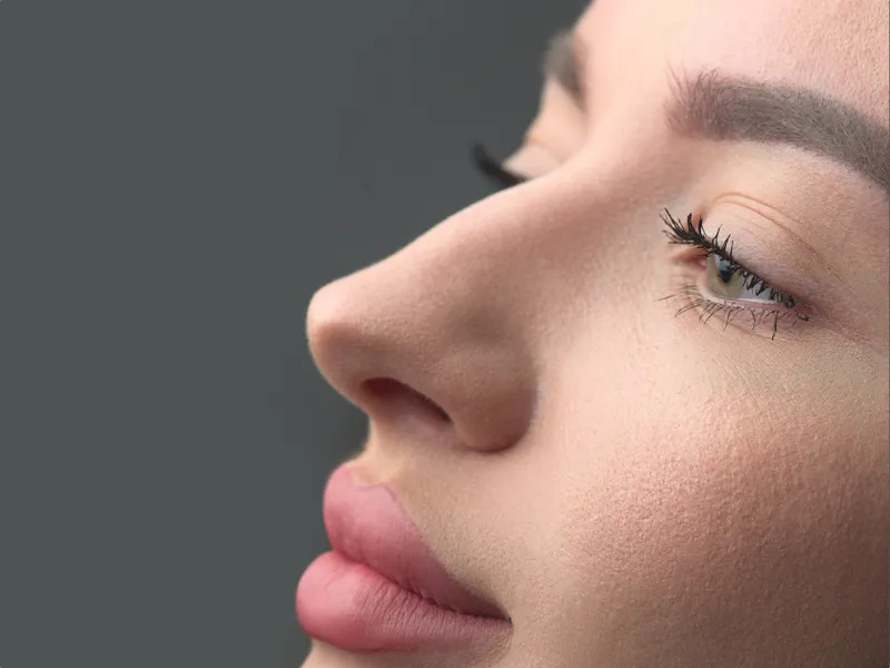 بینی قوزدار ترند شبکه‌های اجتماعی