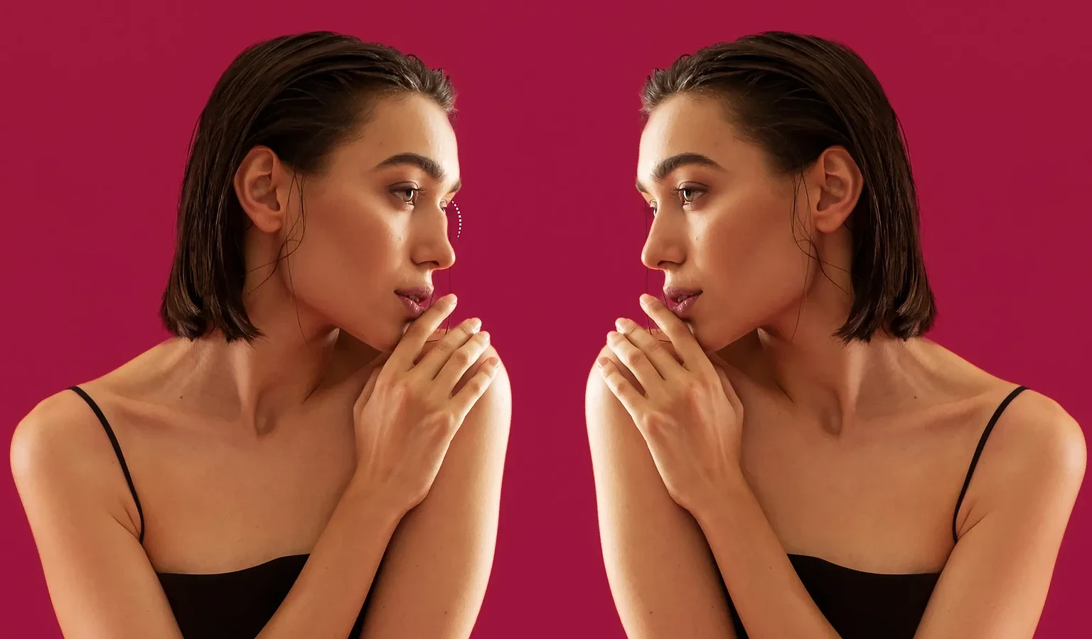 قوز بینی در زیبایی