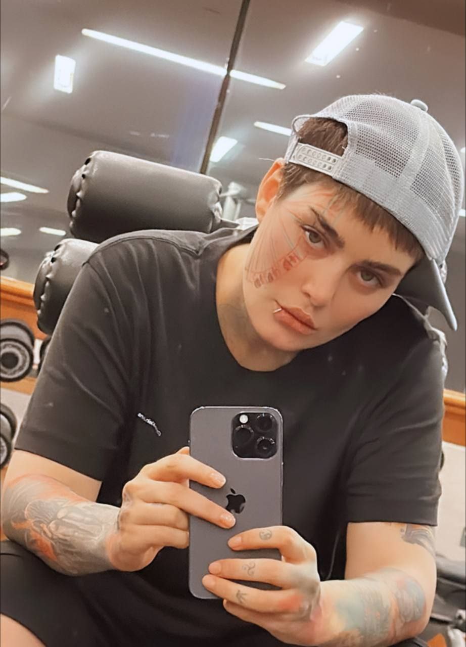 عکس داغ سحر قریشی