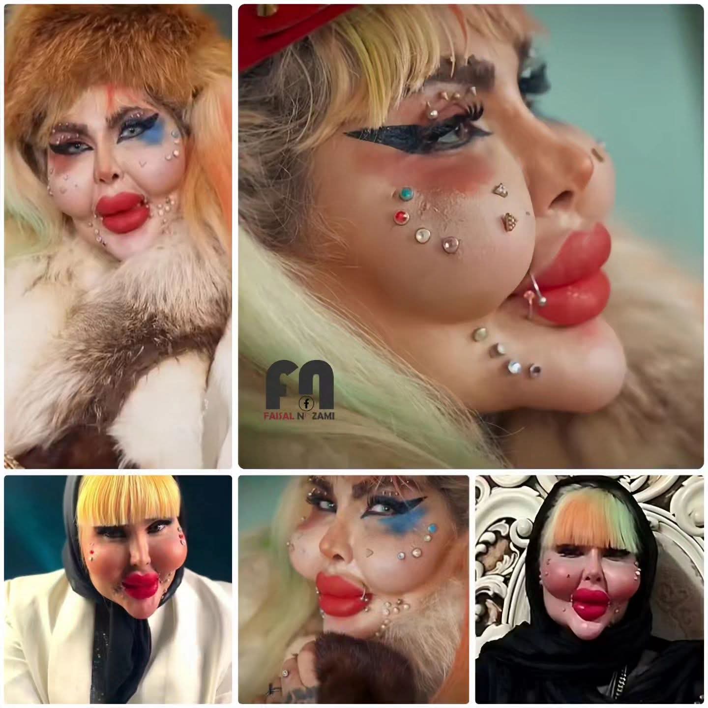 بیشترین جراحی زیبایی جهان بیشترین جراحی زیبایی جهان