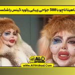 آناهیتا ناچو با ۳۸۸ جراحی زیبایی رکورد گینس را شکست