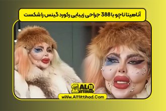 آناهیتا ناچو با ۳۸۸ جراحی زیبایی رکورد گینس را شکست