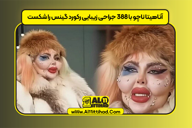 آناهیتا ناچو با ۳۸۸ جراحی زیبایی رکورد گینس را شکست